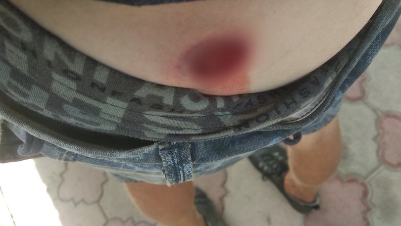 Побиття військовослужбовців цивільними: свідки та сторони події розповіли, що сталося у Бузькому