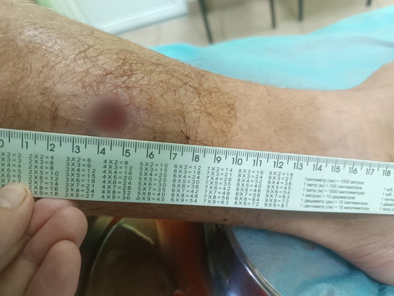 Побиття військовослужбовців цивільними: свідки та сторони події розповіли, що сталося у Бузькому