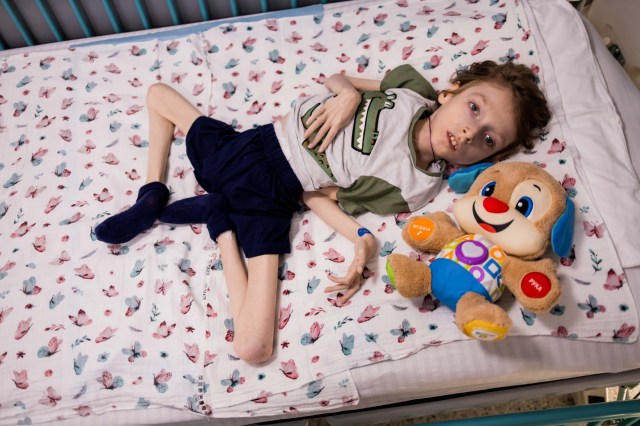 13-річні брати через хворобу не можуть ходити